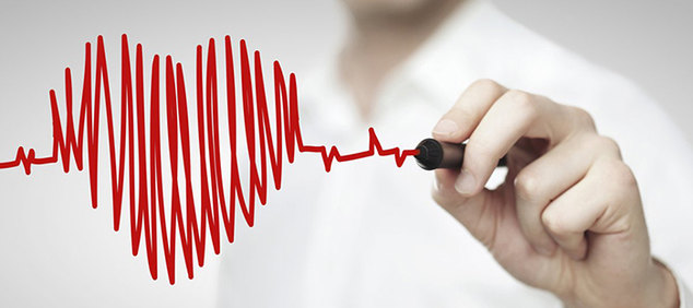 EKG