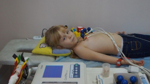 EKG_rebenku_1-500x281