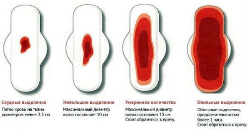 Количество выделений при месячных