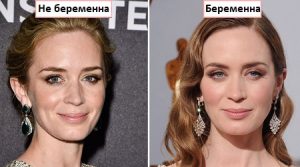 Лицо до беременности и во время