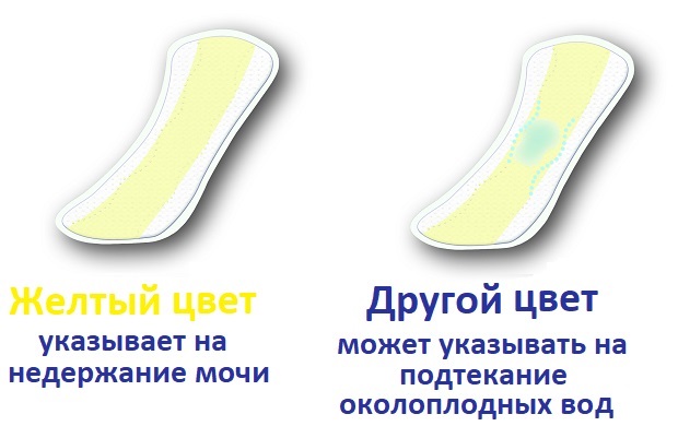 Определение подтекания околоплодных вод по прокладке