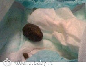 Какахи малышей: Оцениваем содержимое подкузника (брезгливым - МИМО!)