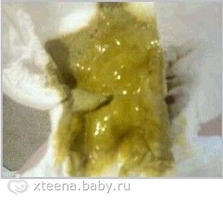 Какахи малышей: Оцениваем содержимое подкузника (брезгливым - МИМО!)