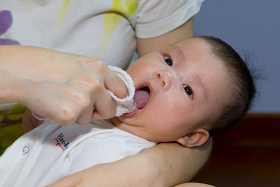 Как лечить молочницу во рту