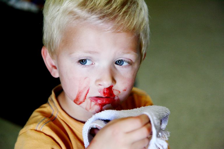 кровь из носа у ребенка