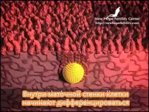 Имплантация клетки