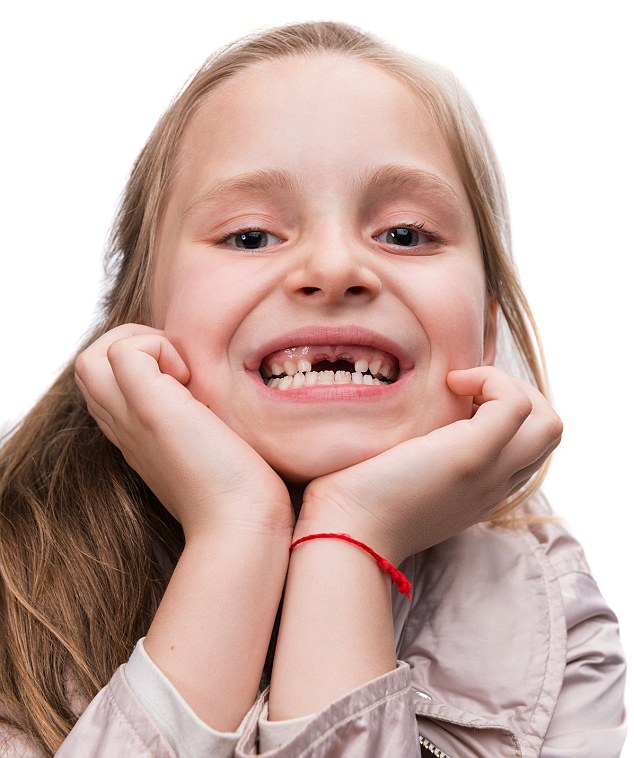 Growing problem: Almost 26,000 children in England aged between five and nine have been hospitalised for multiple tooth extractions in 2013-14 (picture posed by model)
