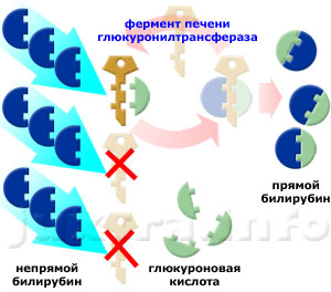 Патогенетический механизм синдрома Жильбера: низкая активность глюкуронилтрансферазы приводит к нарушению трансформации непрямого билирубина в прямой и его задержке в организме
