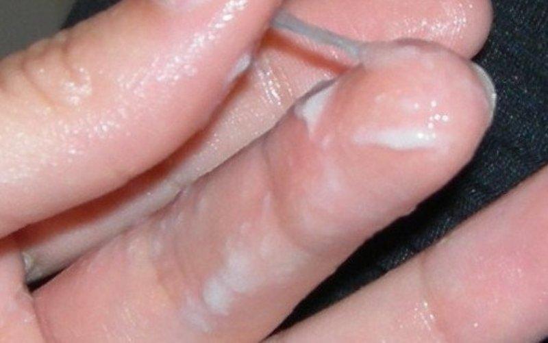 Цервикальная жидкость Цервикальная слизь