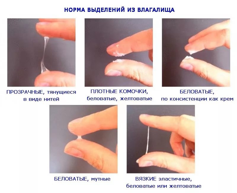 Свечи и другие лекарственные формы от вагинита