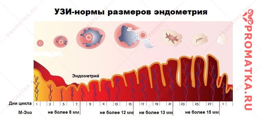 Толщина эндометрия на УЗИ Нормы М-Эха