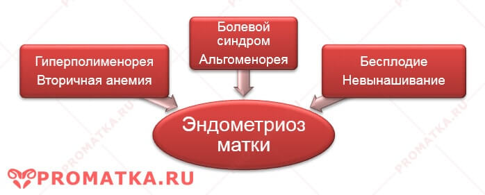 Признаки аденомиоза Признаки эндометриоза матки