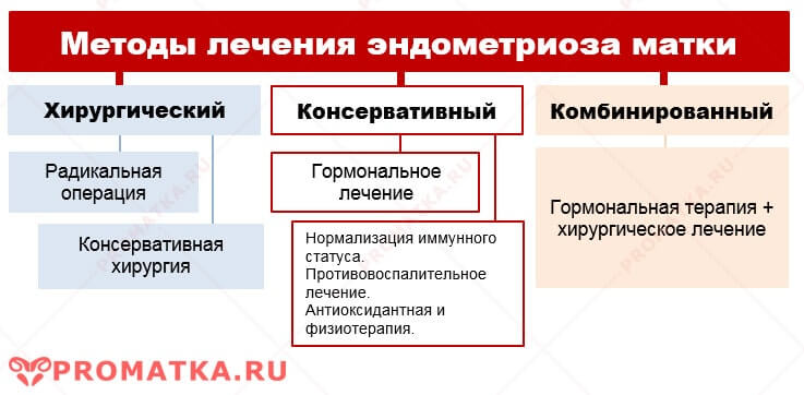 Методы лечения аденомиоза Методы лечения эндометриоза матки