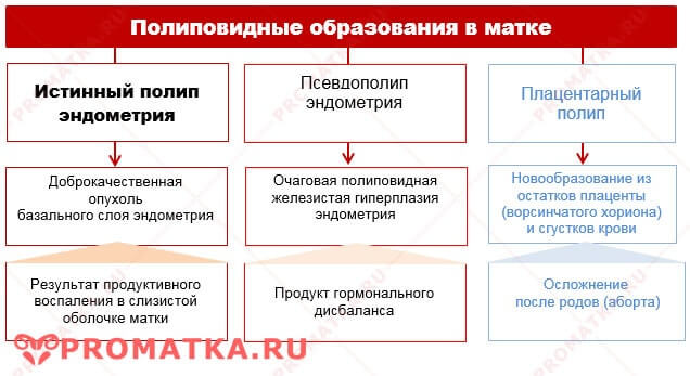 Полипы матки Полипы тела матки схема