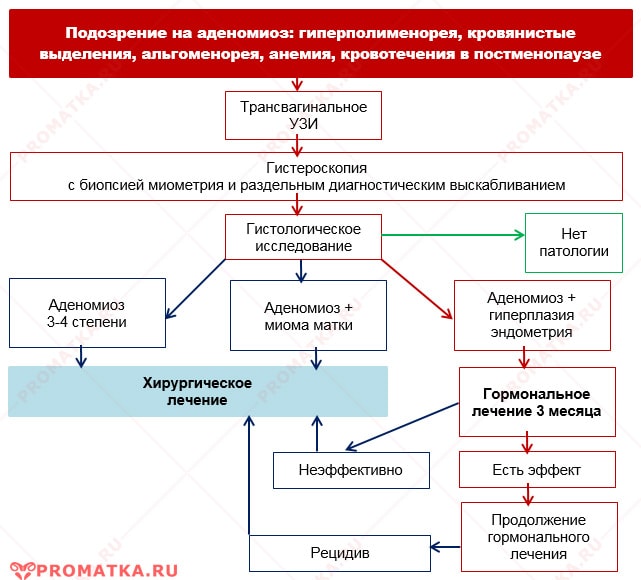 Диагностика и лечение аденомиоза Лечение внутреннего эндометриоза - схема