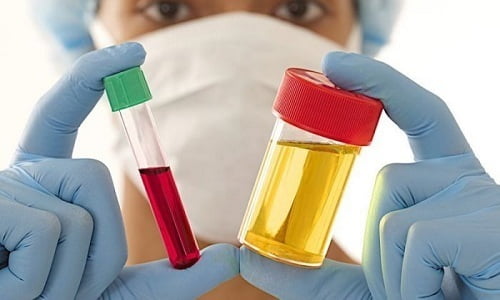 Диагностика детского цистита подразумевает проведение анализа мочи и крови