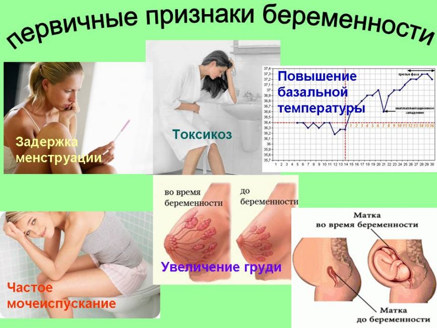 Первичные признаки, которые помогают заподозрить беременность Первичные признаки, которые помогают заподозрить беременность