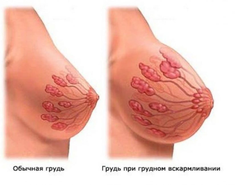 Увеличение молочных желез Увеличение молочных желез